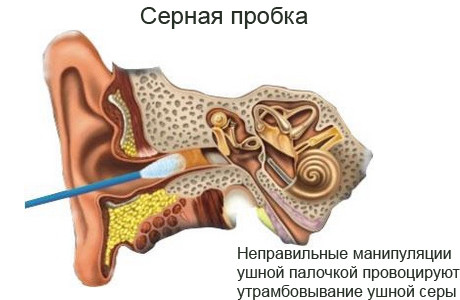 Гигиена ушей