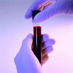 Серологический анализ крови на корь 19