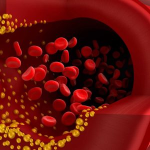 HG475_blood-vessel-cholesterol_FS