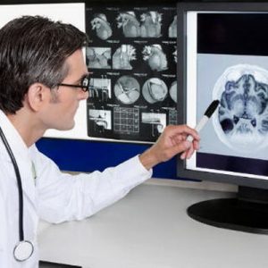 Компьютерная томография мозга 3