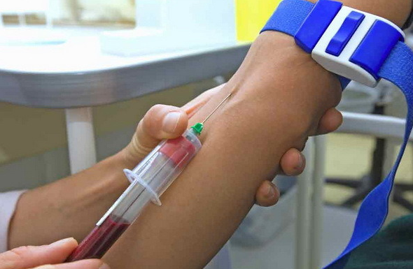 Анализ крови на выявление антител к возбудителям инфекций методом ифа thumbnail