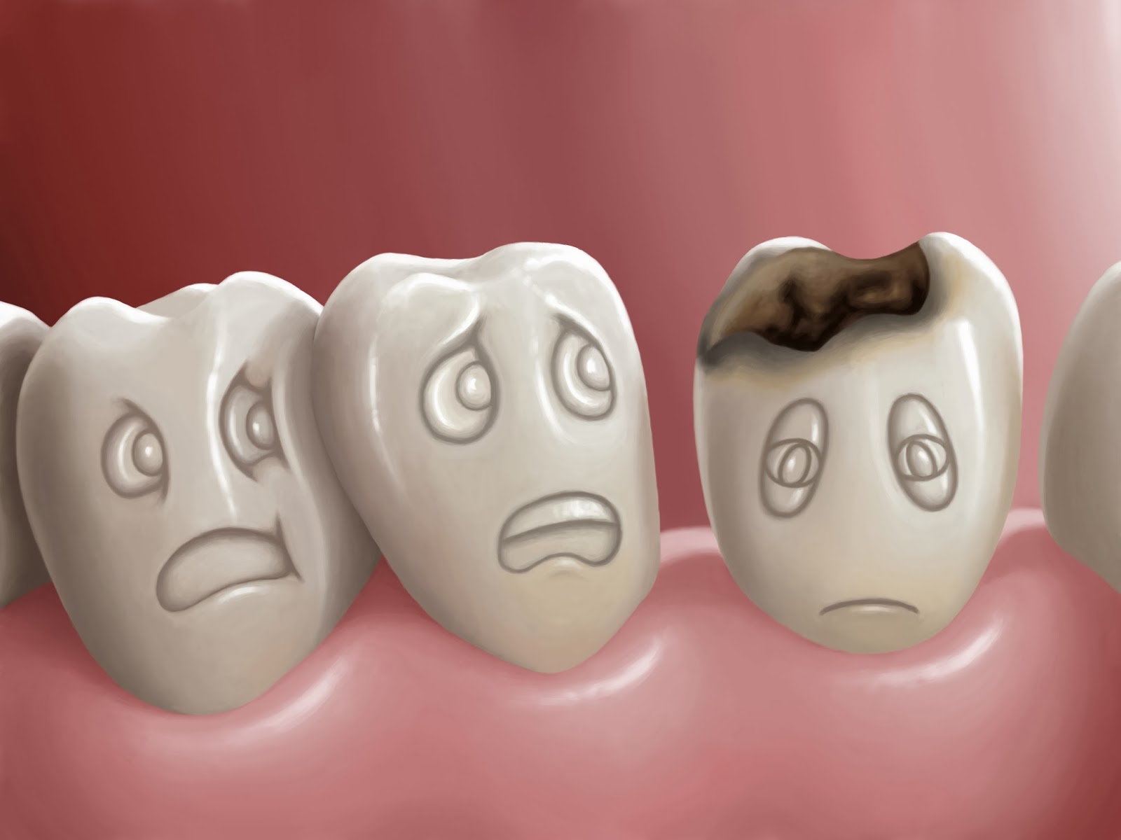 Кариес зубов классификация лечение профилактика thumbnail