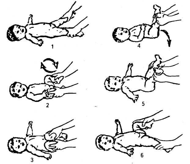 Гимнастика при дисплазии тазобедренных суставов у детей