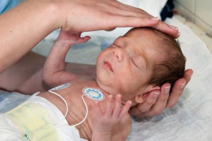 Патологии ЦНС у новорожденных