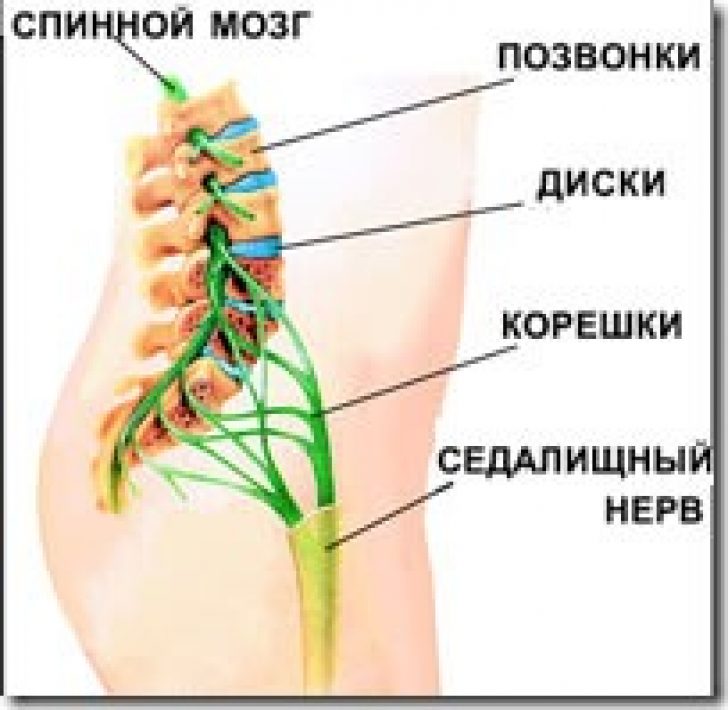 Болит поясница и немеют ноги. Седалищный нерв л5 с1. Спинной мозг седалищный нерв. Схема спинной мозг седалищный нерв. Защемление корешка седалищного нерва.