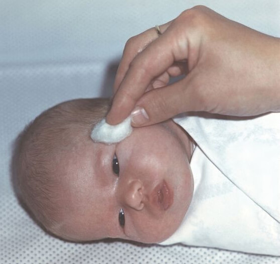 Как вылечить непроходимость слезного канала у новорожденных thumbnail