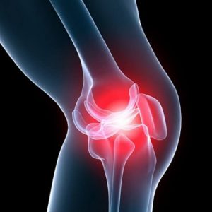 Лечение при артрозе коленного сустава