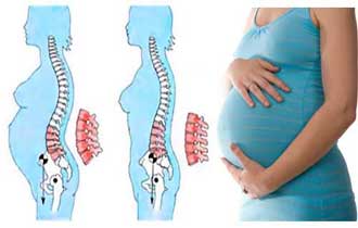 Лечение болей в спине у беременных thumbnail