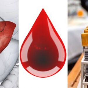 Биохимический анализ крови печеночные пробы у ребенка thumbnail