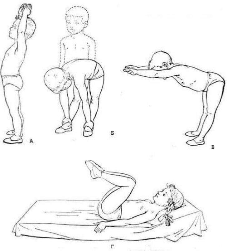Упражнения при запорах на опорожнение кишечника. Упражнения для опорожнения. Запор упражнения. ЛФК при запоре у детей. ЛФК для кишечника.