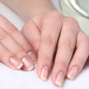 Как вылечить белые полоски на ногтях thumbnail