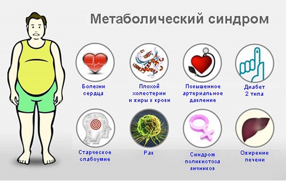 Метаболический синдром: 10 причин, 4 заболевания, входящих в состав синдрома, методы и принципы лечения