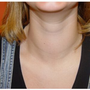 http://thyroid-consultor.ru/wp-content/uploads/2015/01/big.jpg