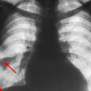 kt-i-rentgen-diagnos-narusheniy-leg-krovoobrasheniya (24) (1)