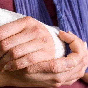Вывих среднего пальца руки лечение в домашних условиях