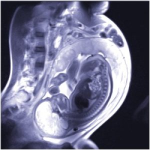 Рентген во время беременности на поздних сроках