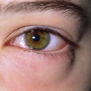 Левомицетин в глаза при аллергии