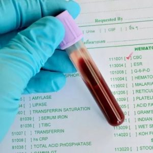 Наличие бактериальной инфекции по анализу крови thumbnail