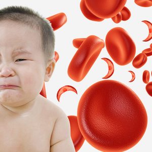 Диетотерапия при железодефицитной анемии у детей
