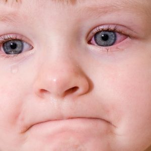Ушиб глаз у ребенка