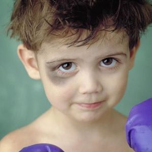 Чем помазать глаз ребенку при ушибе