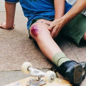 Как вылечить рану на ногах у детей