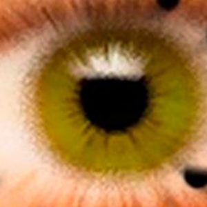Черная точка сетчатки глаза