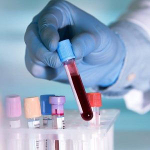 Анализ крови к вэб инфекции