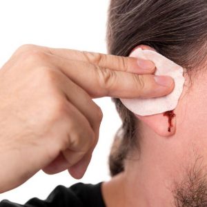 При сильных головных болях кровотечение из ушей