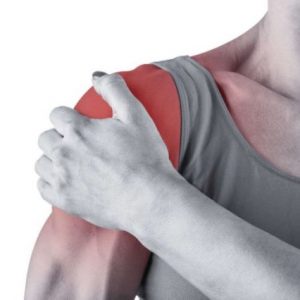 Как вылечить подвывих плечевого сустава thumbnail