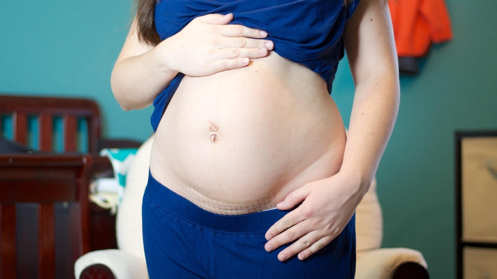 6 недель после родов. Кесарево сечение живот. Кесарева беременность. Живот беременной.