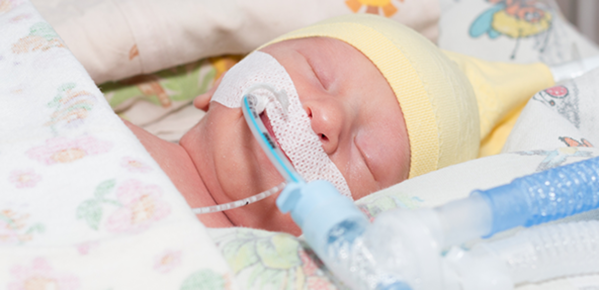 Вентиляция легких новорожденному